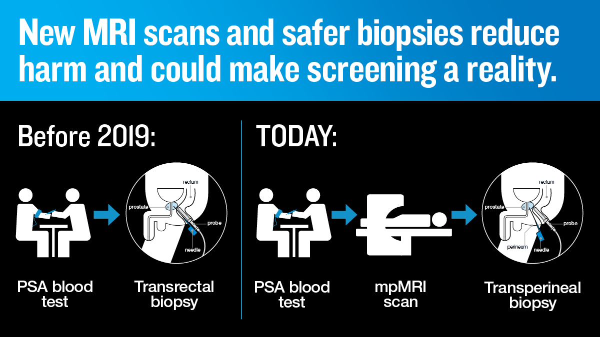Diagram of the screening pathway for prostate cancer, comparing pre-2019 and today. In the pre-2019 section, there is an illustration of a PSA blood test followed by a transrectal biopsy. In the today section, there is a PSA blood test, an mpMRI scan and a transperineal biopsy. The image is titled 'New MRI scans and safer biopsies reduce harm and could make screening a reality'.