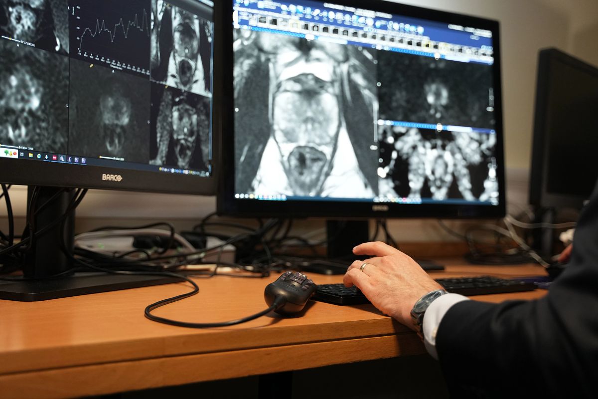 Tristan Barrett Views MRI Scan, Only Hands